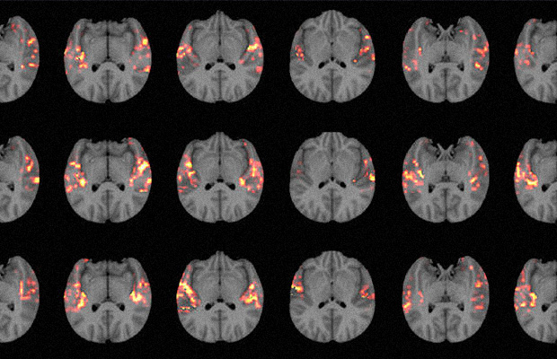 Сканер мозга на 85% угадывает песни, которые ты слушаешь